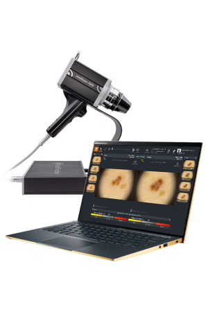 FotoFinder Desktop Gold - Echipament pentru Videodermatoscopie Digitala, Capilaroscopie si Tricoscopie