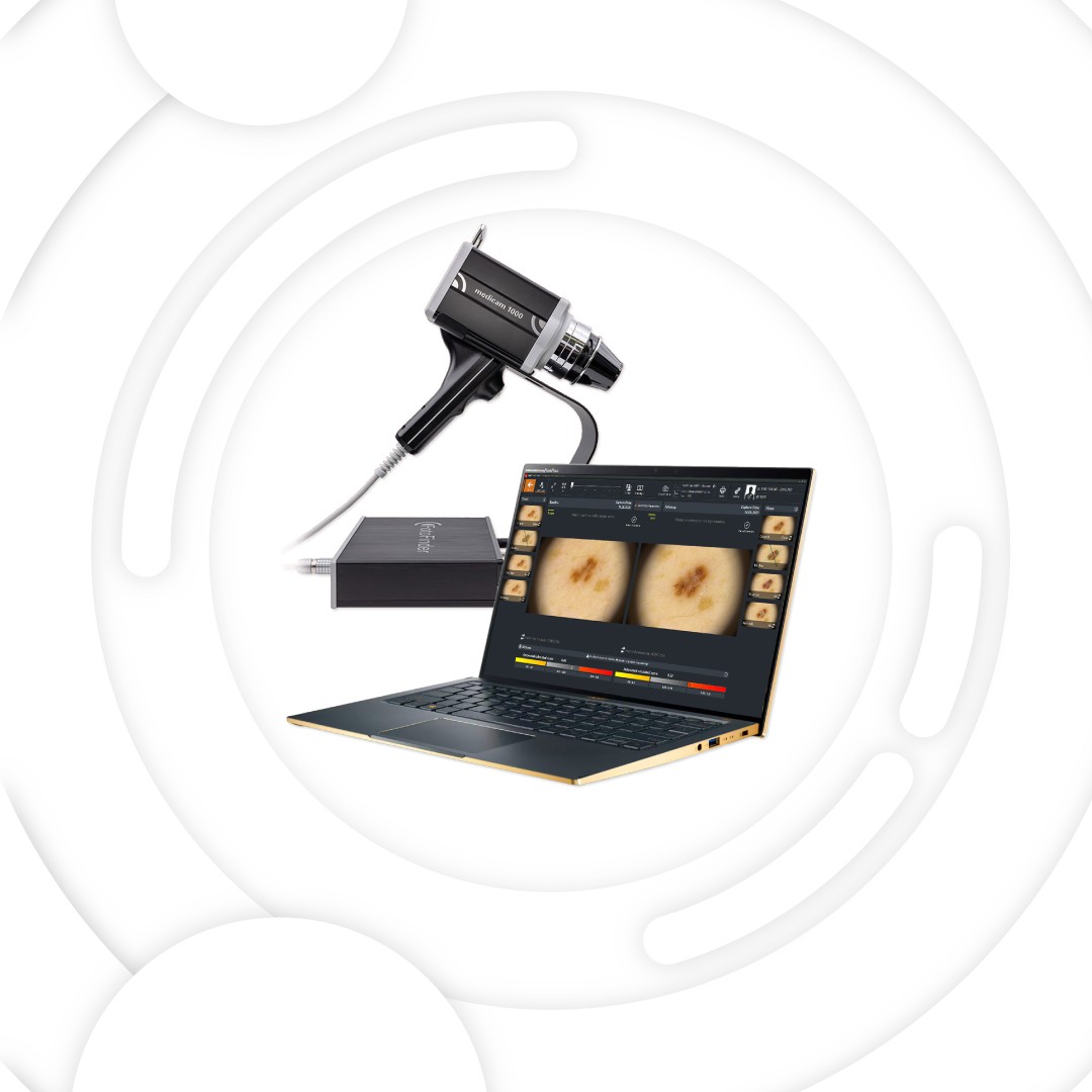 FotoFinder Desktop Gold - Echipament pentru Videodermatoscopie Digitala, Tricoscopie si Capilaroscopie