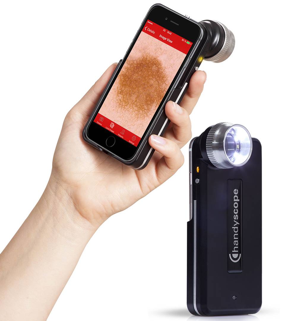 Dermatoscopie digitala pe smartphone - Handyscope by Fotofinder