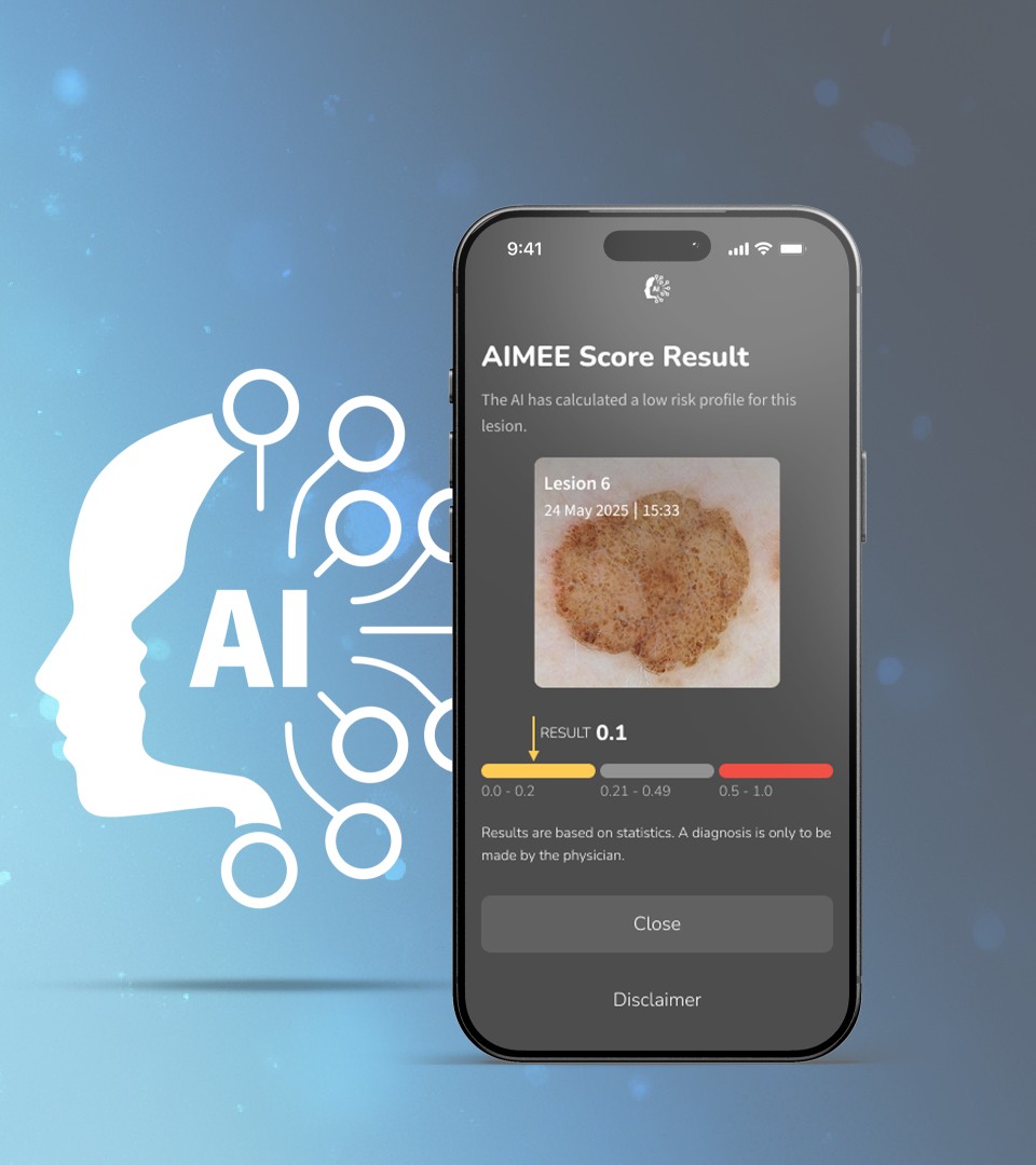 DermLite DL5 Plus FotoFinder - AI Scoring pentru Analiza Imaginilor Dermatoscopice