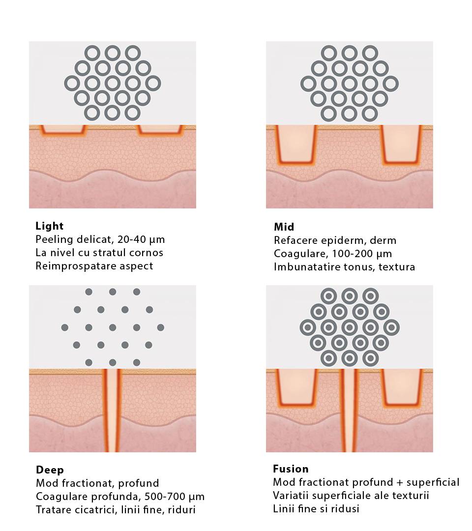 Diverse moduri de tratament ale aparatului laser CO2 CO2RE
