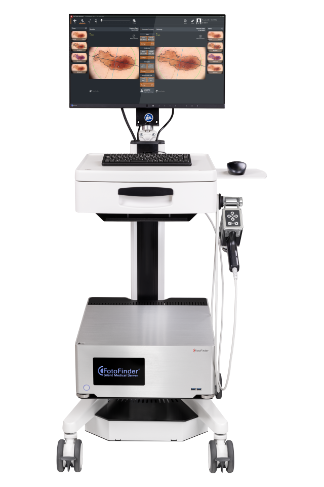 Aparat Vexia - Platforma Avansata de Videodermatoscopie Digitala pentru Medici Dermatologi