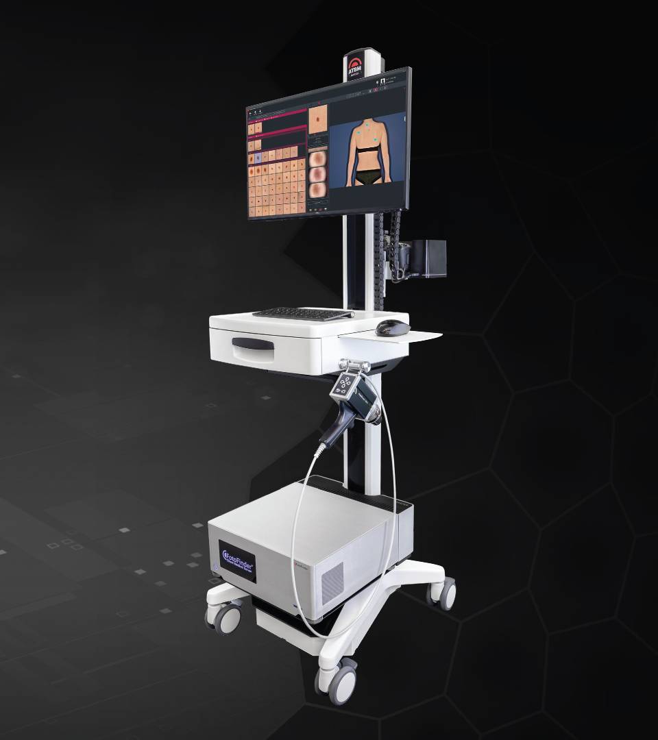 FotoFinder ATBM Master - platforma videodermatoscopie pentru Medici Dermatologi
