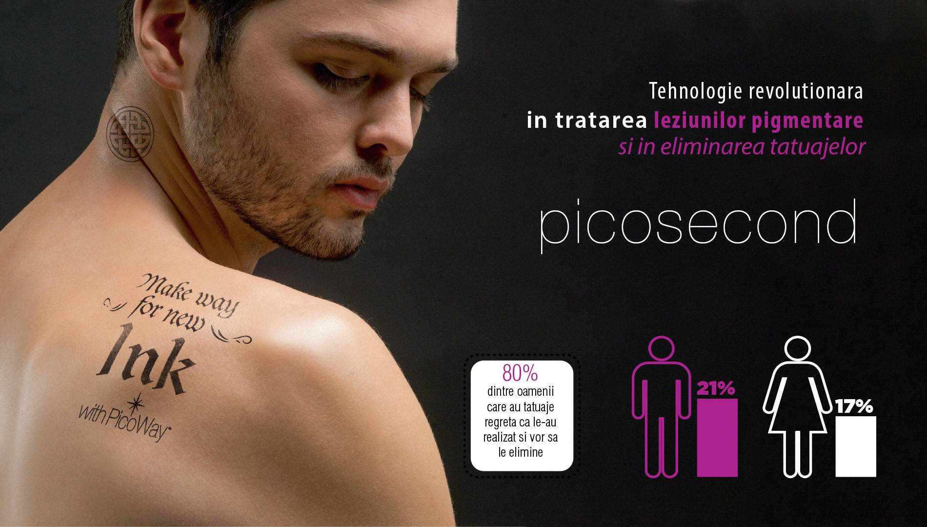 Tehnologia picosecond pentru eliminare tatuaje