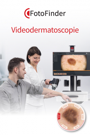 Aparatura Videodermatoscopie - Aparate Profesionale Dermatoscopie