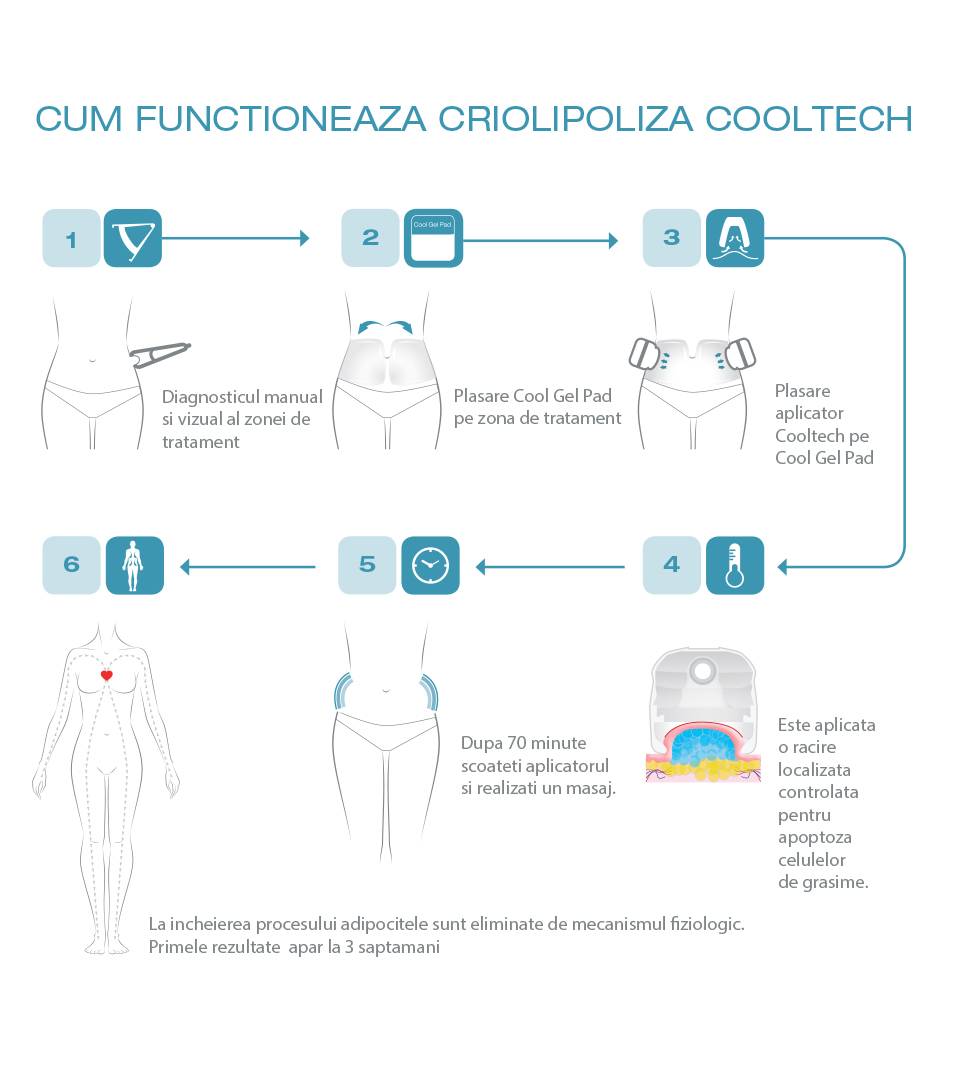 Cum Functioneaza Criolipoliza Cooltech - Pasii Tratamentului
