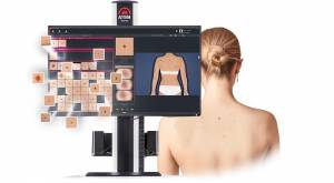 ATBM Master - Cea mai avansata platforma de imagistica pentru medici dermatologi
