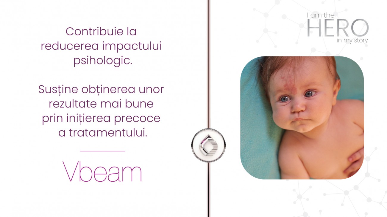 Tot ce Trebuie sa Stii despre Malformatiile Capilare Congenitale si Tratamentul Modern